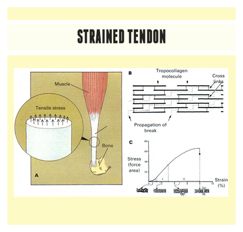 Strained_tendon